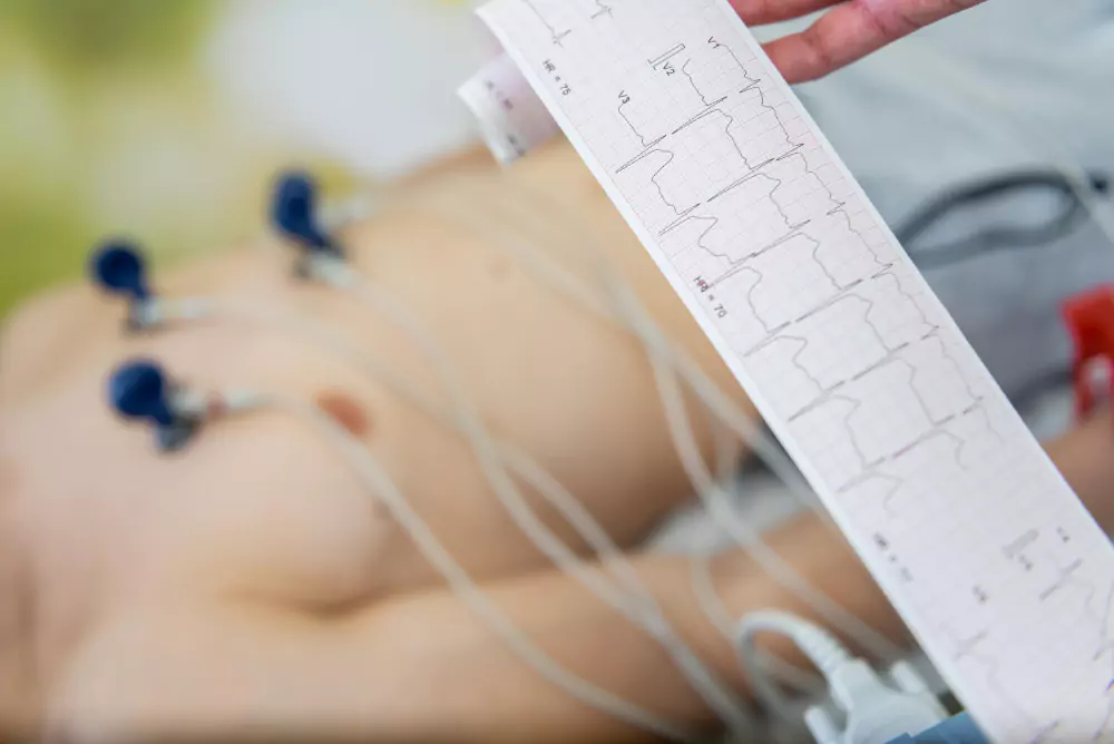 Electrocardiogram (ECG)