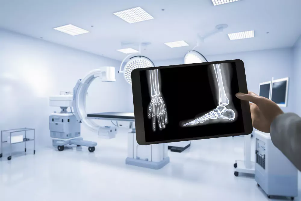 Digital X-Ray